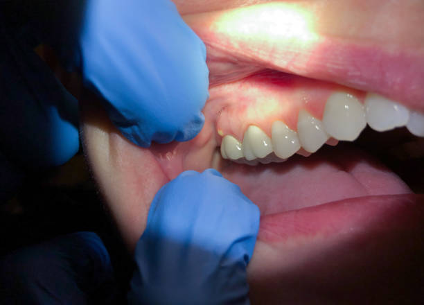 Best Broken Tooth Emergency  in Rainbow Springs, FL
