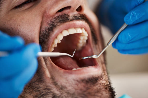 Best Tooth Infection Emergency Dentist  in Rainbow Springs, FL